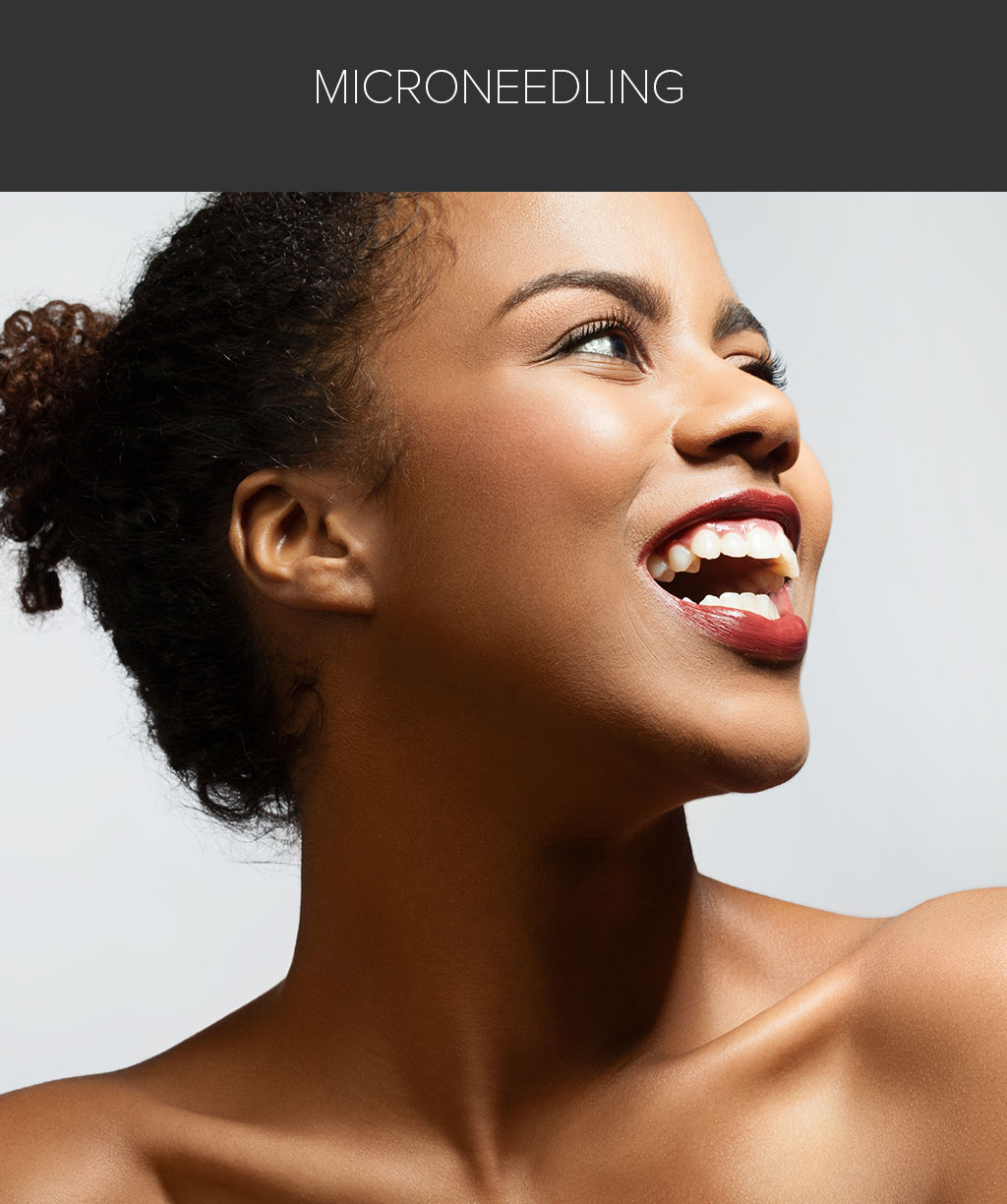 Microneedling