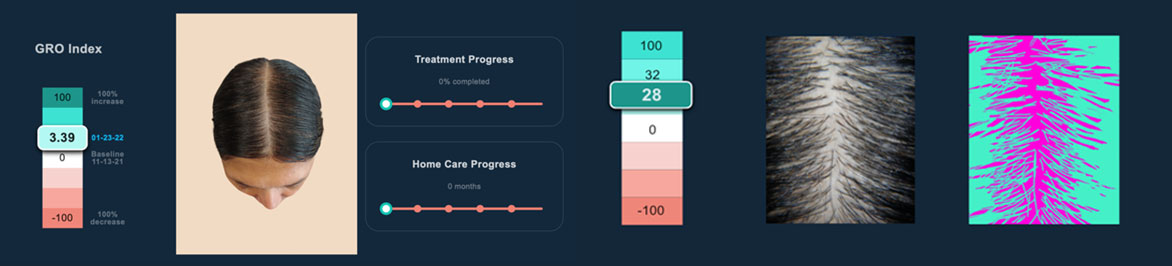 GroTrack Hair & Scalp Analysis